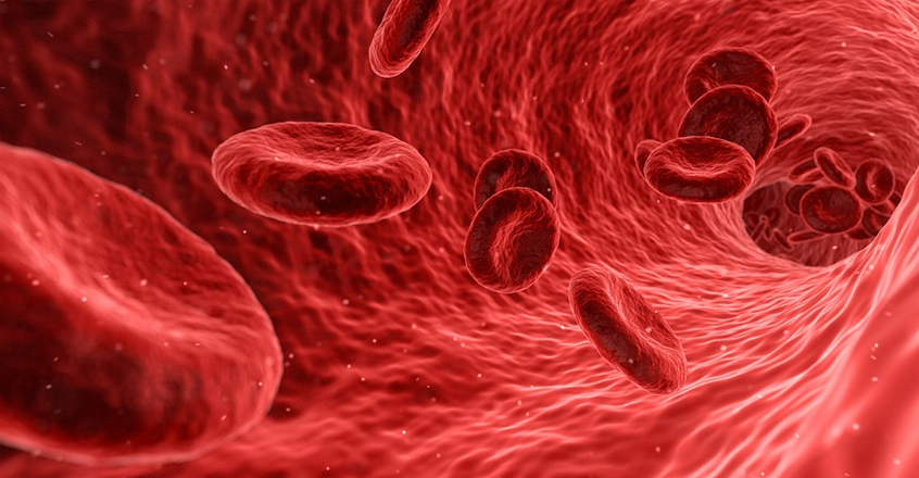 Iron Deficiency Anemia – Causes, Diets, & Treatments